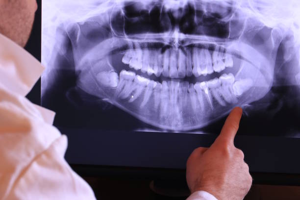Best Broken Tooth Emergency  in Lavallette, NJ