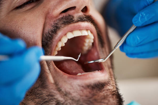 Best Knocked-Out Tooth Emergency  in Lavallette, NJ